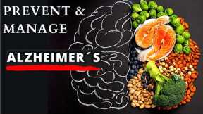 Best Diets to Prevent Dementia & Alzheimer´s