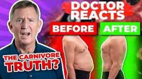 REVIEWING Mark Sisson: The Truth About The Carnivore Diet Interview (HIGHLIGHTS) - Doctor Reacts